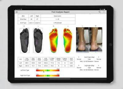 اسکن کف پا چه چیزی را نشان می دهد؟ اسکن کف پا چه چیزی را نشان می دهد؟